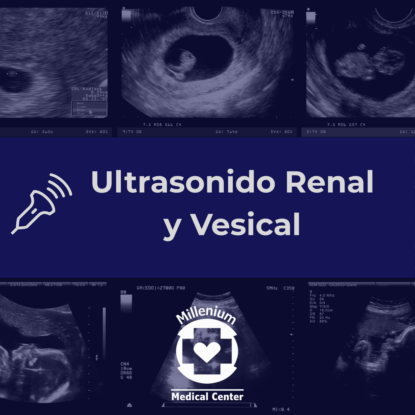 Ultrasonido Renal y Vesical