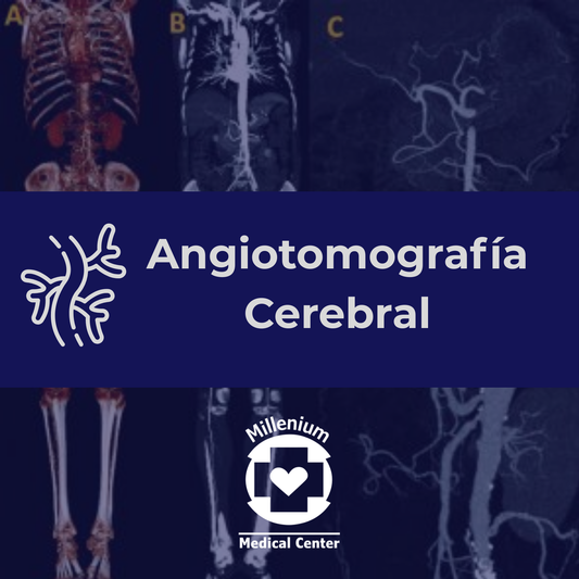 Angiotomografía Cerebral