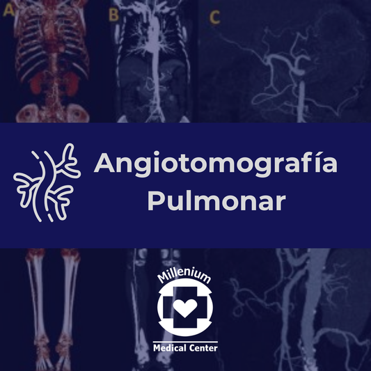 Angiotomografía Pulmonar