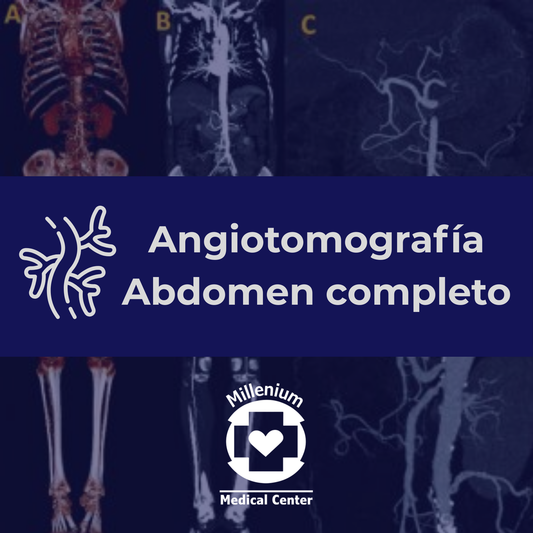 Angiotomografía Abdomen Completo