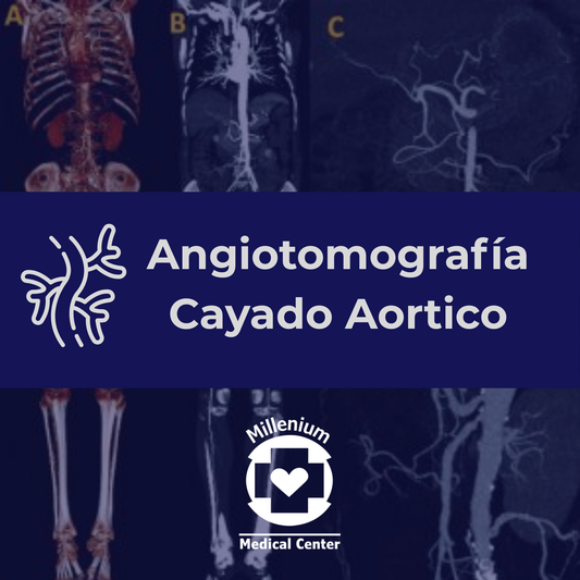 Angiotomografía Cayado Aortico