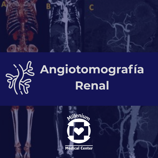Angiotomografía Renal