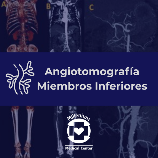 Angiotomografía Miembros Inferiores