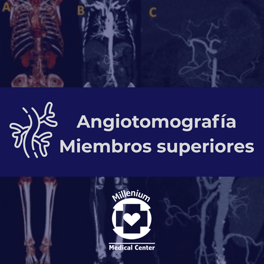 Angiotomografía Miembros Superiores