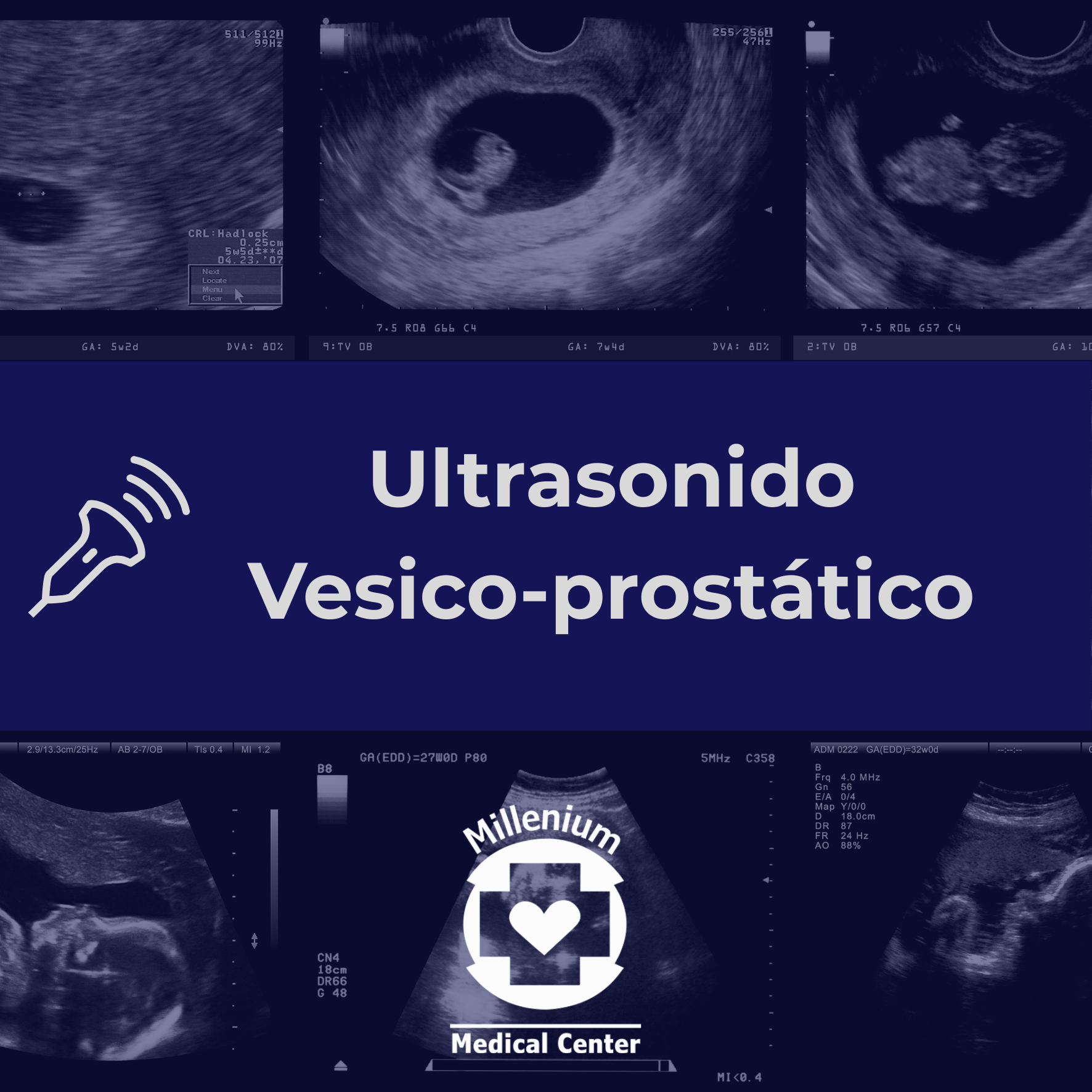 Ultrasonido Vesico-Prostático – Hospital Millenium