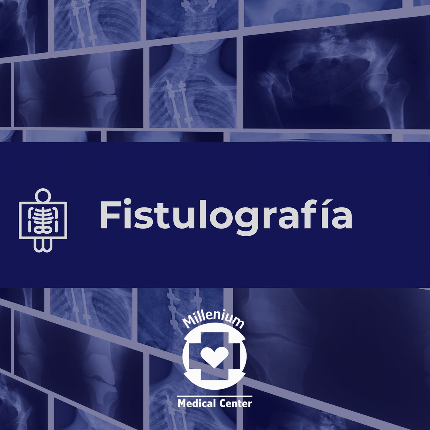 Fistulografía