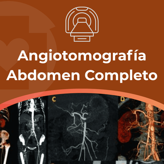 Angiotomografía Abdomen Completo
