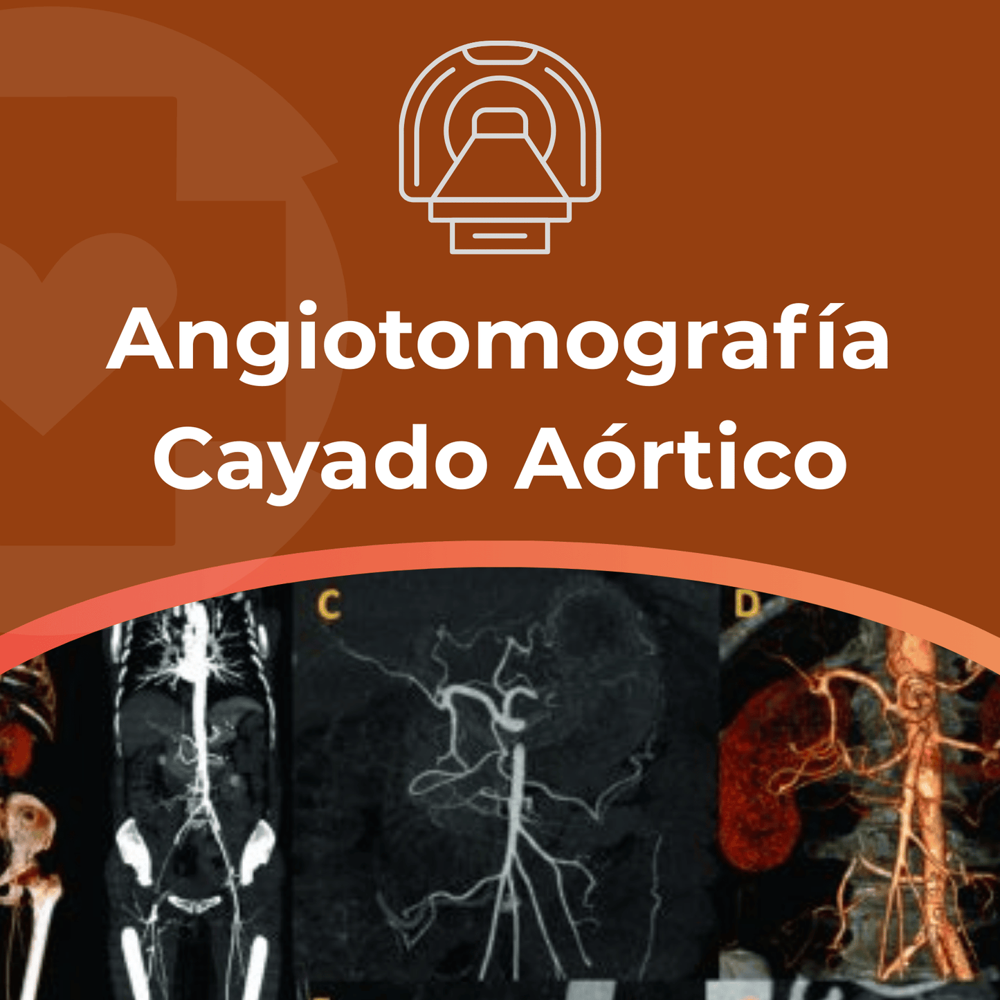 Angiotomografía Cayado Aortico