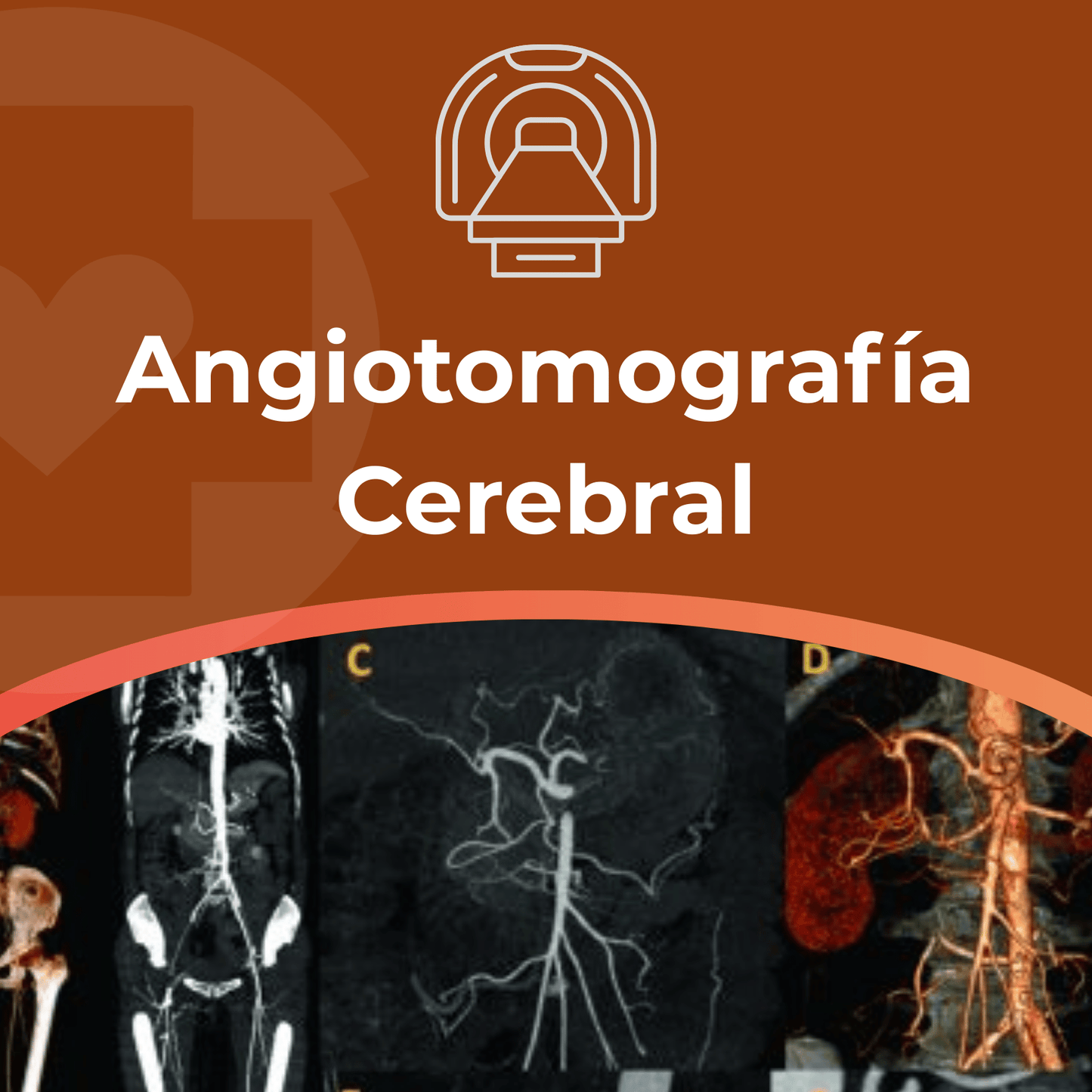 Angiotomografía Cerebral