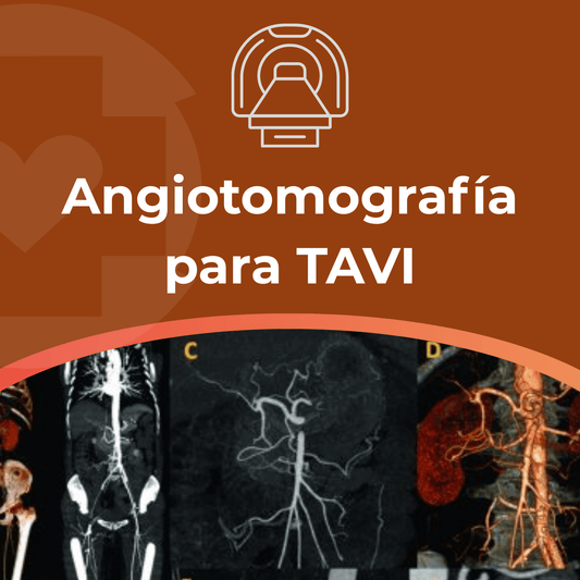 Angiotomografía para TAVI