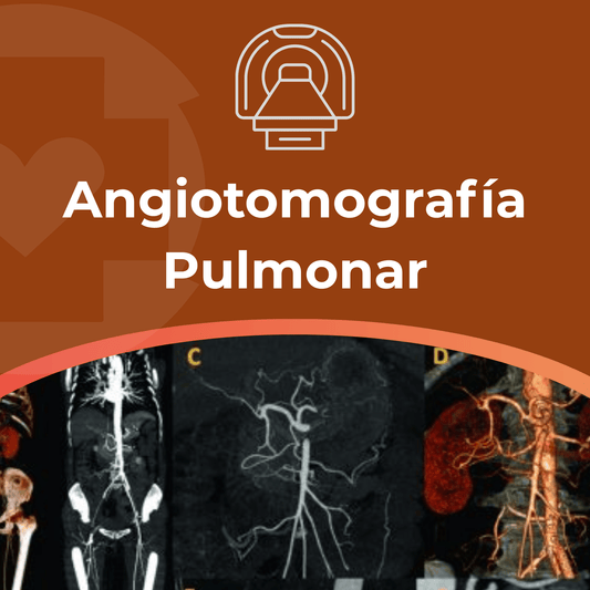 Angiotomografía Pulmonar