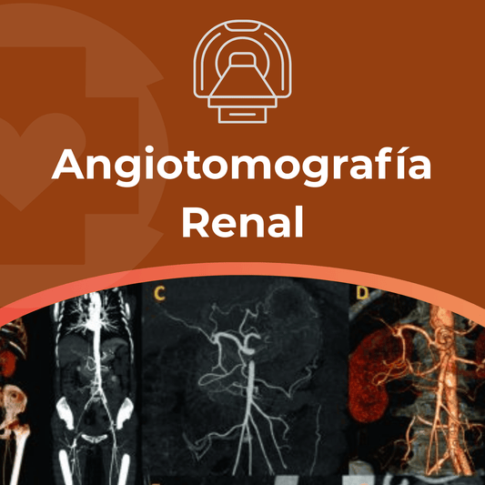 Angiotomografía Renal